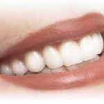 tanden-bleken-logo